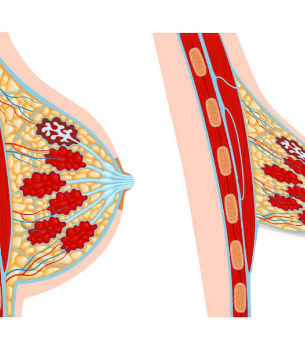 Cómo identificar mamas tuberosas