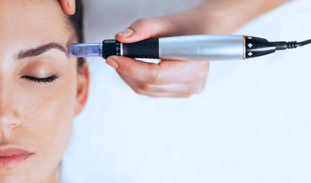 dermapen