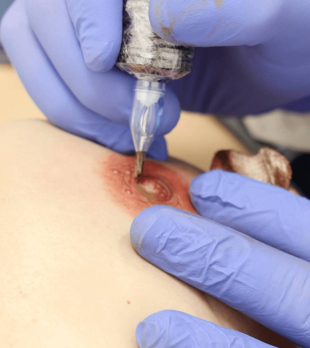 micropigmentacion de areola